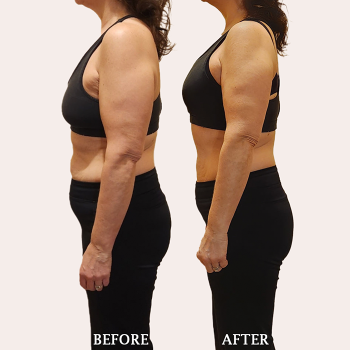 Weightloss &amp; Metabolic Resets.