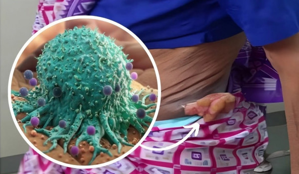 Saree Cancer Risks: How to Drape Safely and Comfortably