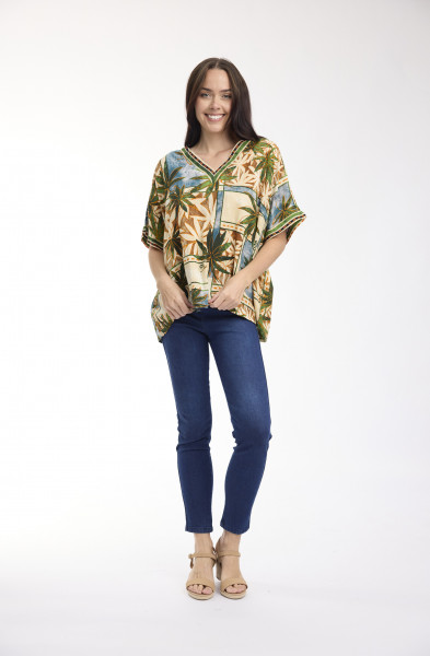 Allard Top Oversize