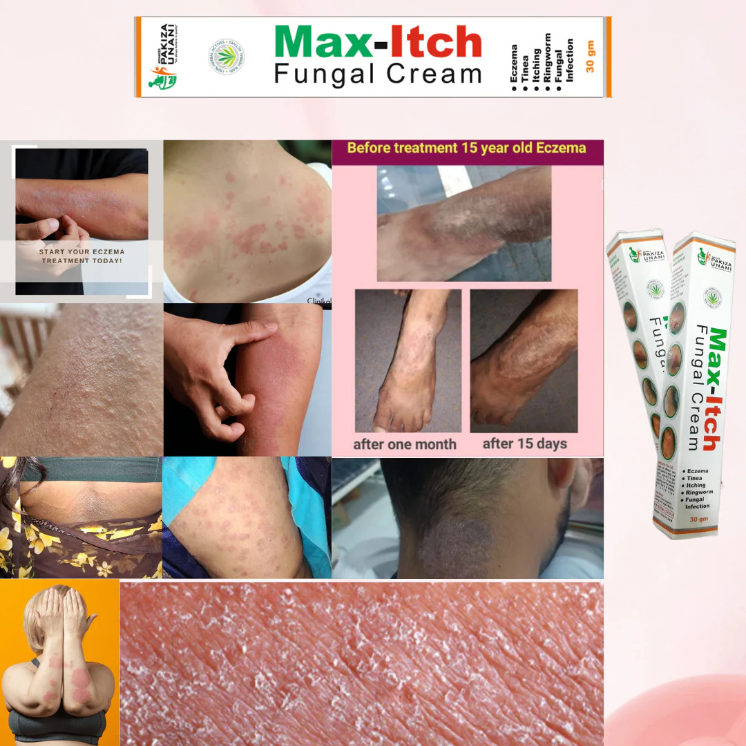 Max-Itch Fungal Cream Pakiza Unani 30g