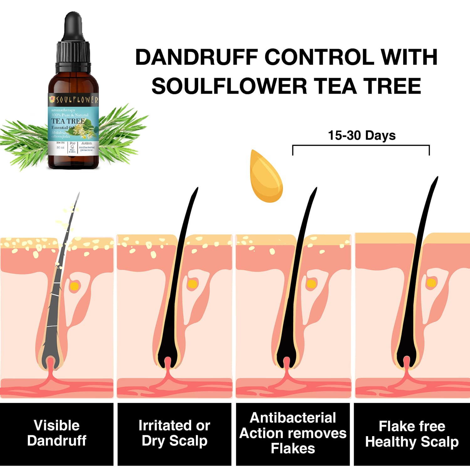 Soulflower Tea Tree Essential Oil 15ml for Dandruff and Acne